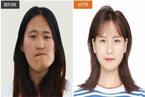 中方脸什么意思(方脸中分好看吗)
