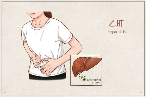 乙肝是很严重的病吗(乙肝是很严重的病吗一)