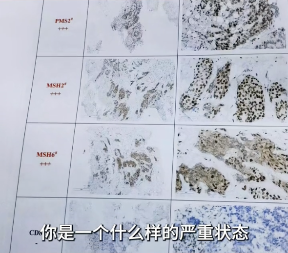 消失9个月，知名女作家自曝患癌！这些症状千万警惕